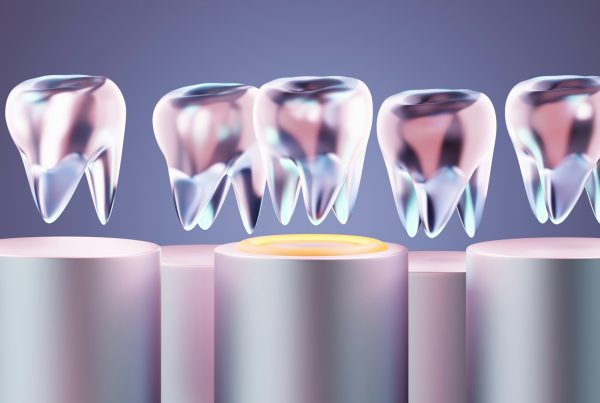 Prix des implants dentaires